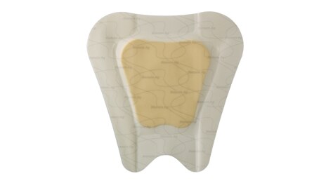 Treatment of a Stage III sacral pressure injury