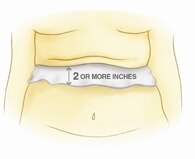 skin fold textile skin fold textile