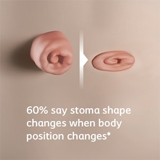 <h4><em><strong>The stoma changes shape during movement</strong></em> and the area around it can retract or extend.</h4>